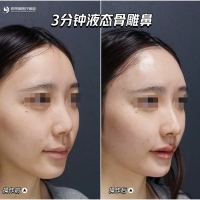 德備小區(qū)  127㎡ 毛坯三房 南北通透戶型  每平米7000多 可直接過戶