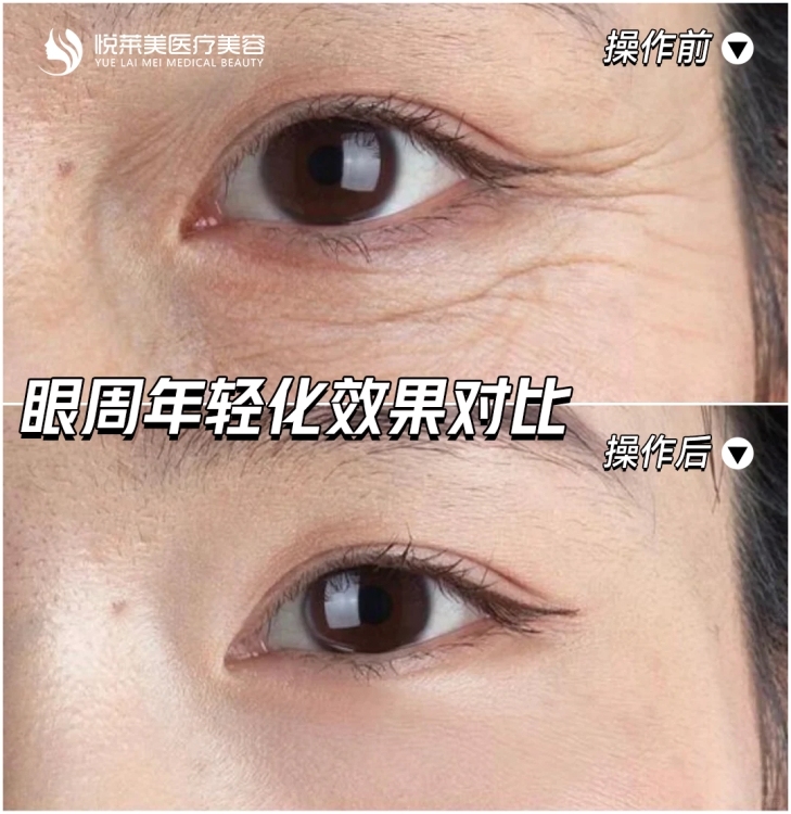寶泰花苑  109㎡ 毛坯三房 好樓層 每平米7500元  可直接過戶