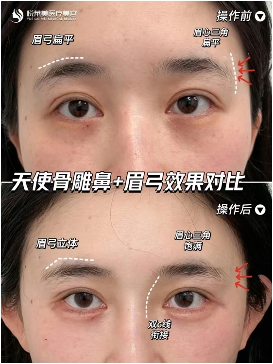 美倫山景疊苑  12㎡ 電梯口  22.5萬(wàn)